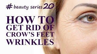 How to get rid of Crow’s Feet Wrinkles and rejuvenate skin around the eyes