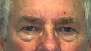 Dr Mike Yates - DYA Plastic Surgery - Cosmetic Procedures for Men