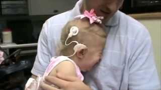 Cochlear Implants: People hearing for the first time!