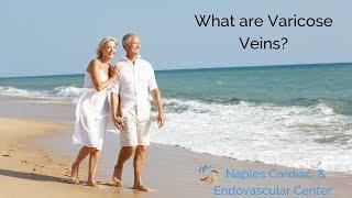 What are Varicose Veins? Naples Heart & Vein