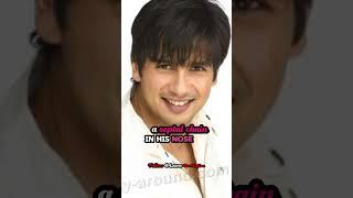 Did Shahid Kapoor Undergone Rhinoplasty? Shahid Kapoor's Transformation: Rhinoplasty Journey