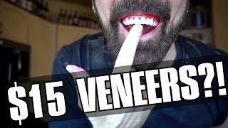 Perfect Smile Veneers Review: $15 Veneers?