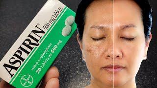  % Effective! REMOVE DARK SPOTS FROM YOUR FACE IN 10 MINUTES WITH 2 ASPIRINS! ASPIRIN BOTOX mask