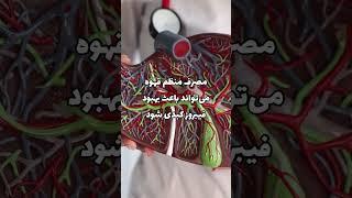 فواید قهوه برای کبد چرب