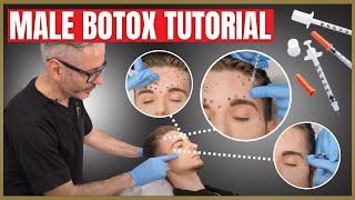 Botox Tutorial For Men | Botox Injection Patterns | Forehead, Corrugators & Crows Feet