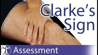 Clarke's Sign / Patellar Grind Test | Patellofemoral Pain / Chondromalacia Patellae