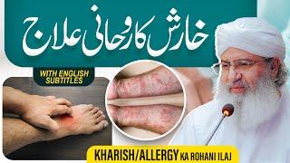 Kharish (Itch) Ka Rohani Ilaj | Kharish Khatam Karne Ka Tariqa | Haji Shahid Attari