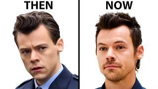 Harry Styles Hair Transplant | Plastic Surgery Analysis