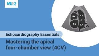 Echocardiography Essentials: Mastering the apical four-chamber view (4CV)