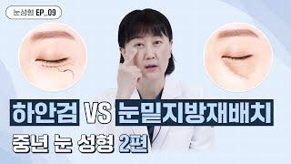 Lower Blepharoplasty vs. Lower Eyelid Fat Repositioning(Middle-Aged Pt 2): If you had to choose One?