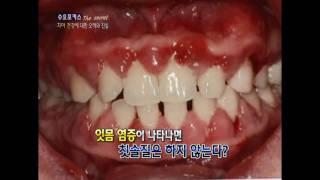 "치아건강에 대한 오해와 진실", - [연세스위트치과병원]