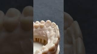 INCROYABLE ! Cette Machine Reproduit la Forme des Dents #shorts #dental #formlabs #3dprinting