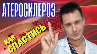 Лечение атеросклероза! Чего боятся бляшки в сосудах?