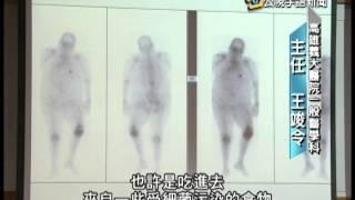 20140505 公視手語新聞 大腸桿菌高抗藥 入侵人體關節奪命