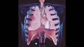 Movement of the diaphragm during respiration | 호흡 중 다이어프램의 움직임.