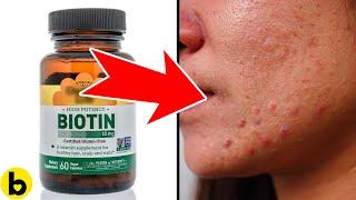 7 Serious Side Effects Of Biotin