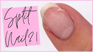 HOW TO FIX A BROKEN NAIL \\ SPLIT NAIL REPAIR TUTORIAL | THE GEL BOTTLE INC