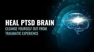 Heal PTSD Brain | Cleanse Yourself Out From Traumatic Experience | Powerful PTSD Cure | 417 hz Music