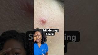 Still getting spots as an adult? Here’s why and what can help! @LaRochePosay #EFFACLARAZ #ad