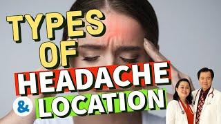 Types of Headache and Location - Tips by Doc Willie Ong (Internist & Cardiologist)