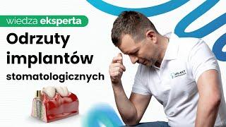 Odrzucenie Implantu - Czy Mogą Się Przydarzyć?