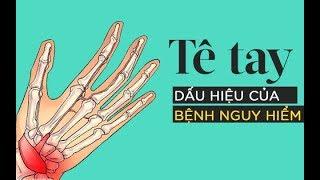 Bị tê tay vào ban đêm là dấu hiệu cảnh báo hội chứng ống cổ tay rất nguy hiểm