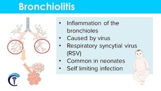 Bronchiolitis: Causes, Classification, Symptoms, Diagnosis and Treatment