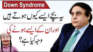 What Is Down Syndrome | Causes, Signs & Symptoms And Treatment | By Dr. Khalid Jamil Akhtar