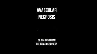 Avascular Necrosis