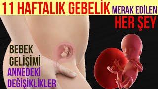 11 Haftalık Gebelik (2023)