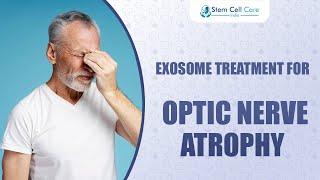 Exosome Treatment For Optic Nerve Atrophy | Eye Disease Treatment | Stem Cell For Vision Restoration