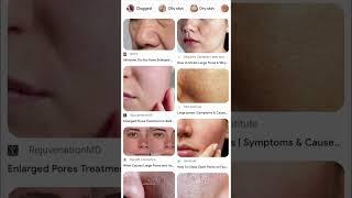 Skin concerns & their solutions 