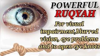 RUQYAH CURE  : VISUAL IMPAIRMENT, BLURRED VISION,EYE PROBLEMS DUE TO MAGIC, JINN AND EVIL EYE