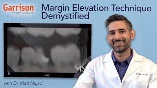 Margin Elevation Technique Demystified with Dr Matt Nejad