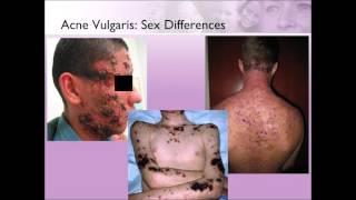 Bethanee Schlosser, MD, PhD Presents "Sex Differences in Skin Disease"