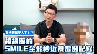 我把眼睛變大了！？視網膜的 Smile全飛秒 近視雷射記錄