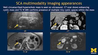 Imaging pancreatic cyst