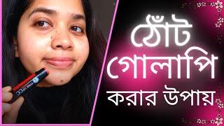  ঠোঁটের কালো দাগ দূর ও ঠোঁট গোলাপি করার উপায় । Solution for Dark Lips