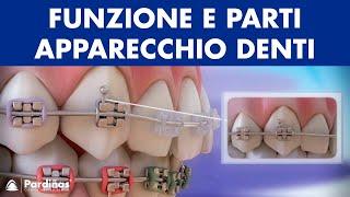 Ortodonzia - Funzione e parti apparecchio denti ©