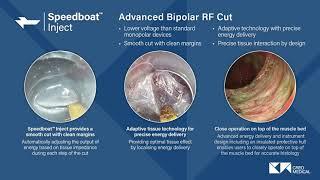 Speedboat: 5-in-1 features for submucosal dissection