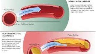 Papa yi cucumber (ED treatment) - Dr WAN