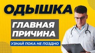 ОДЫШКА ГЛАВНАЯ ПРИЧИНА! ЭТО СЕРДЦЕ?