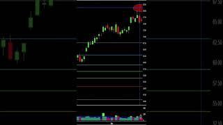 Stock Chart Price Prediction (Real Fibonacci Example) SHOPify Stock Demonstration