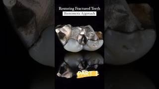  Restoring Fractured Teeth with a Biomimetic Approach! 