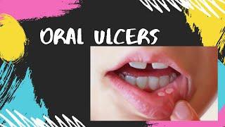 Oral ulcer treatment मुँह के छालो से राहत