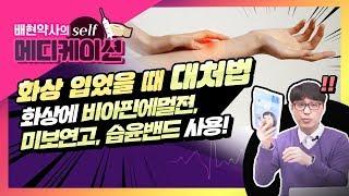 배현 약사 [링거TV] 셀프메디케이션 하기 - 화상 입었을 때 대처법