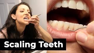 Scaling Your Own Teeth At Home