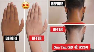 How to Remove Sun Tan at Home (Home Remedy) | Hands, Neck, Knee, Face  - SAHIL