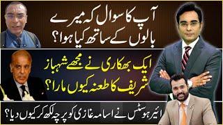 What happened to my hair? answering FAQ | Asad Ullah Khan