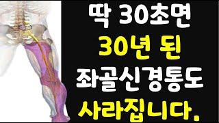 30초만에 방사통 일명 좌골신경통 즉시 없애주는 기가 막히는 운동